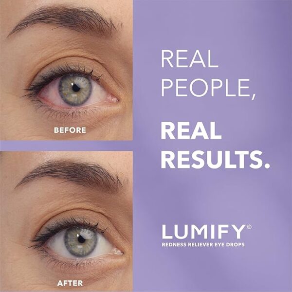 LUMIFY Redness Reliever Eye Drops, 0.08 FL OZ (2.5mL)/ Lumify Eye Drop - Image 2